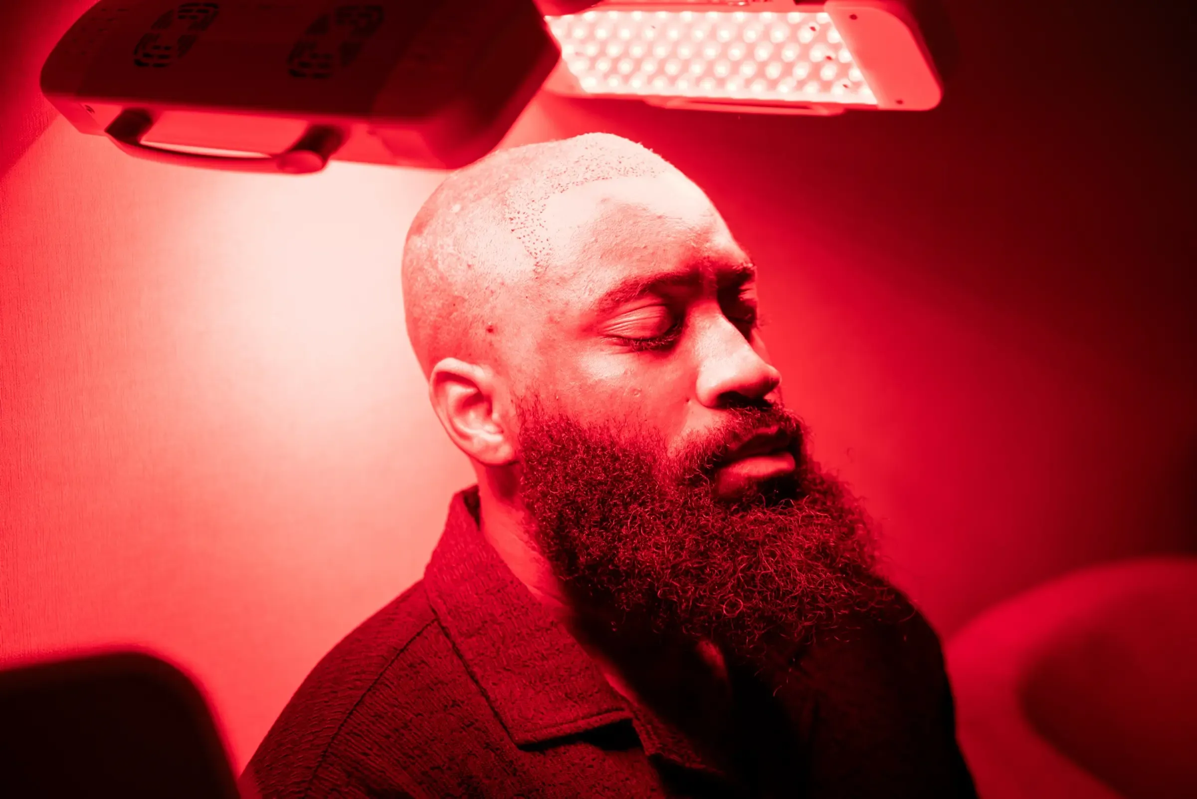 A patient in profile beneath a red LED therapy panel during a scalp treatment session