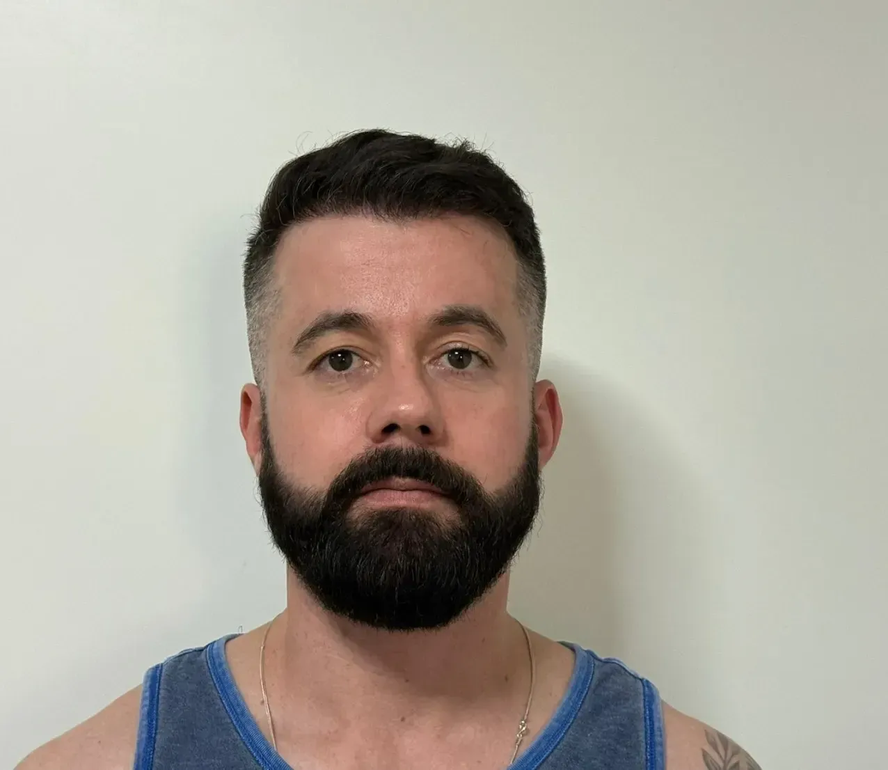 After hair transplant