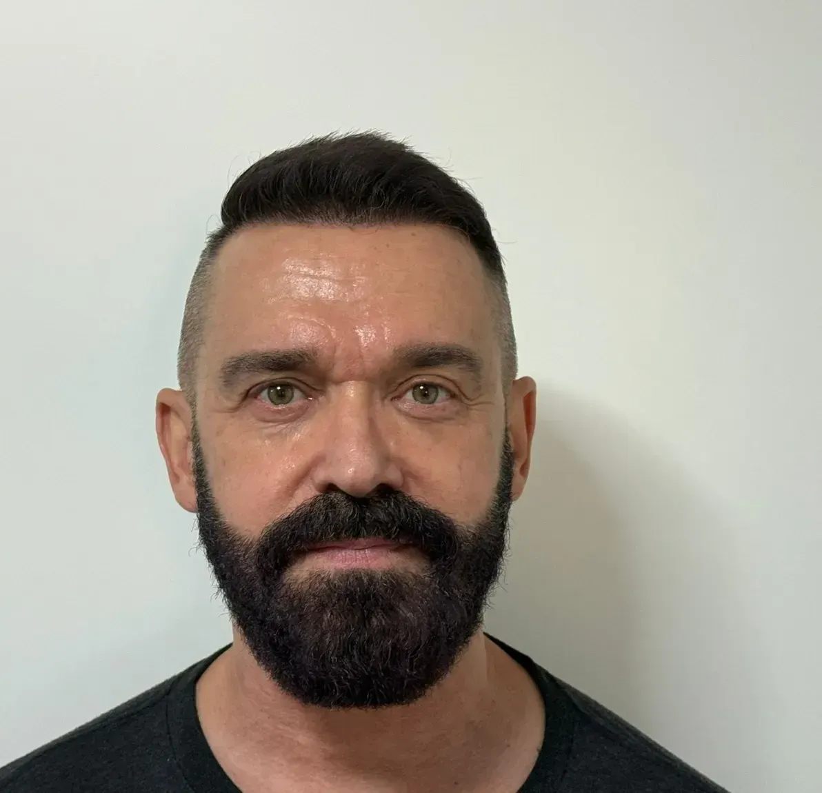After hair transplant
