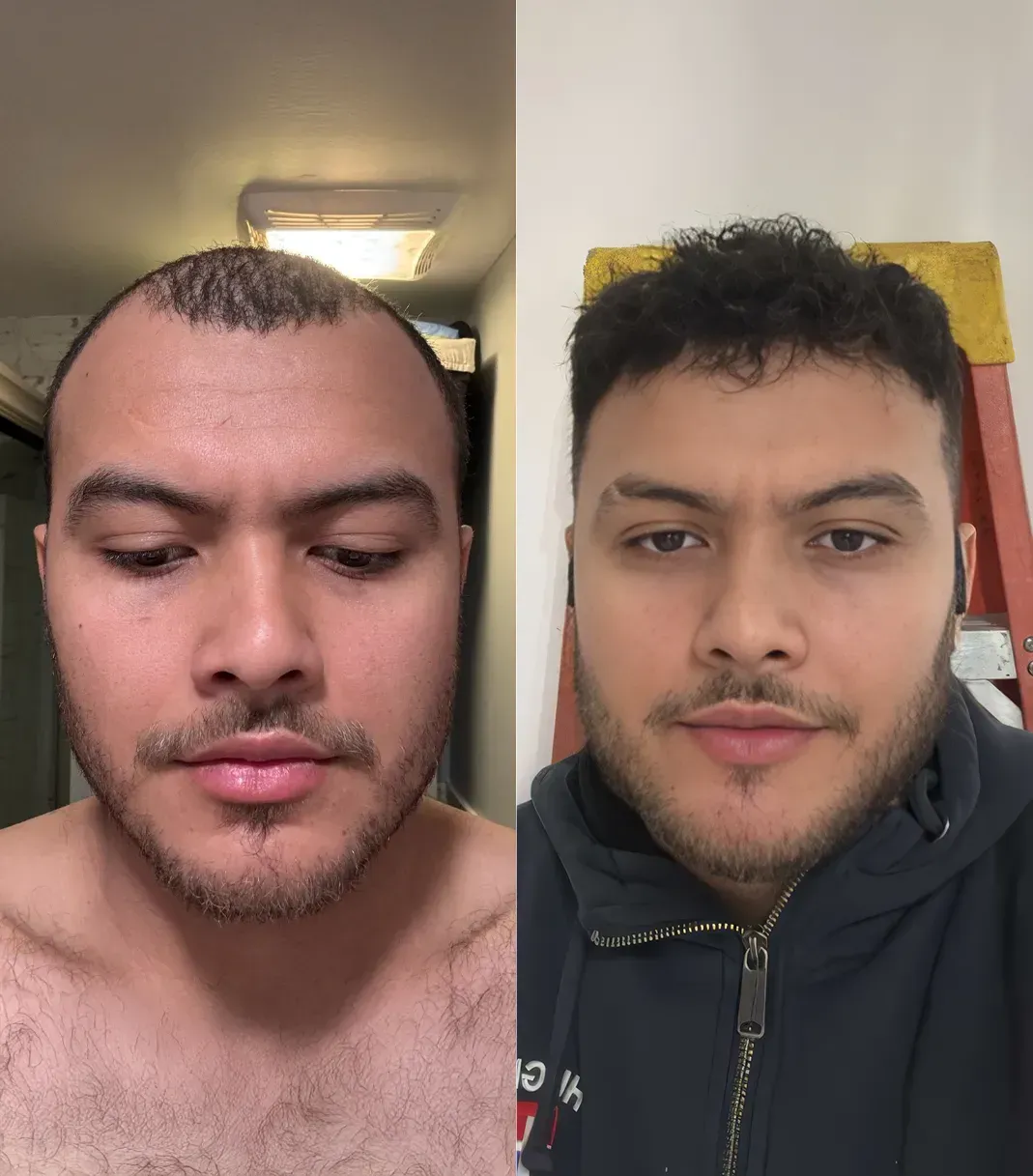Chris W. before and after
