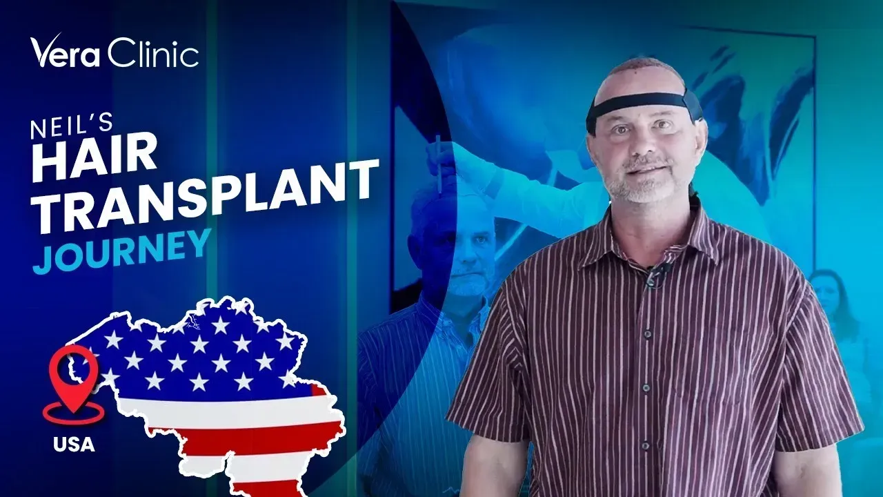 Hair transplant patient at Vera Clinic