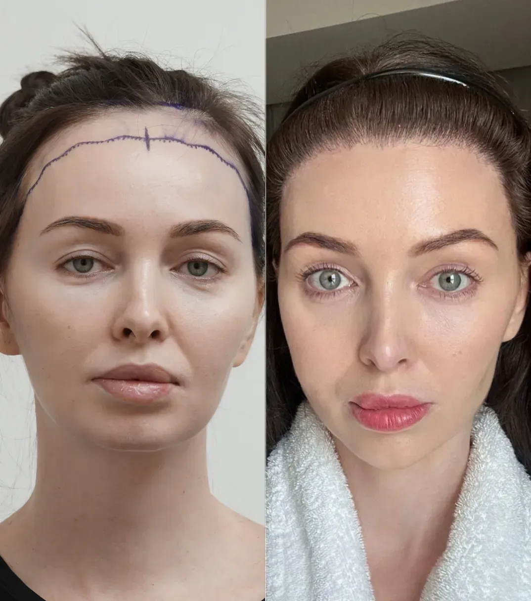 Sarah W. before and after