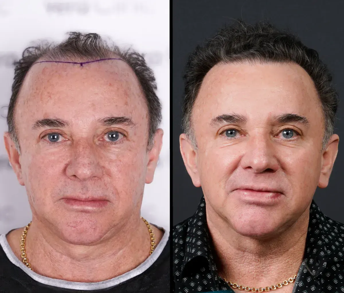 Kevin S. before and after