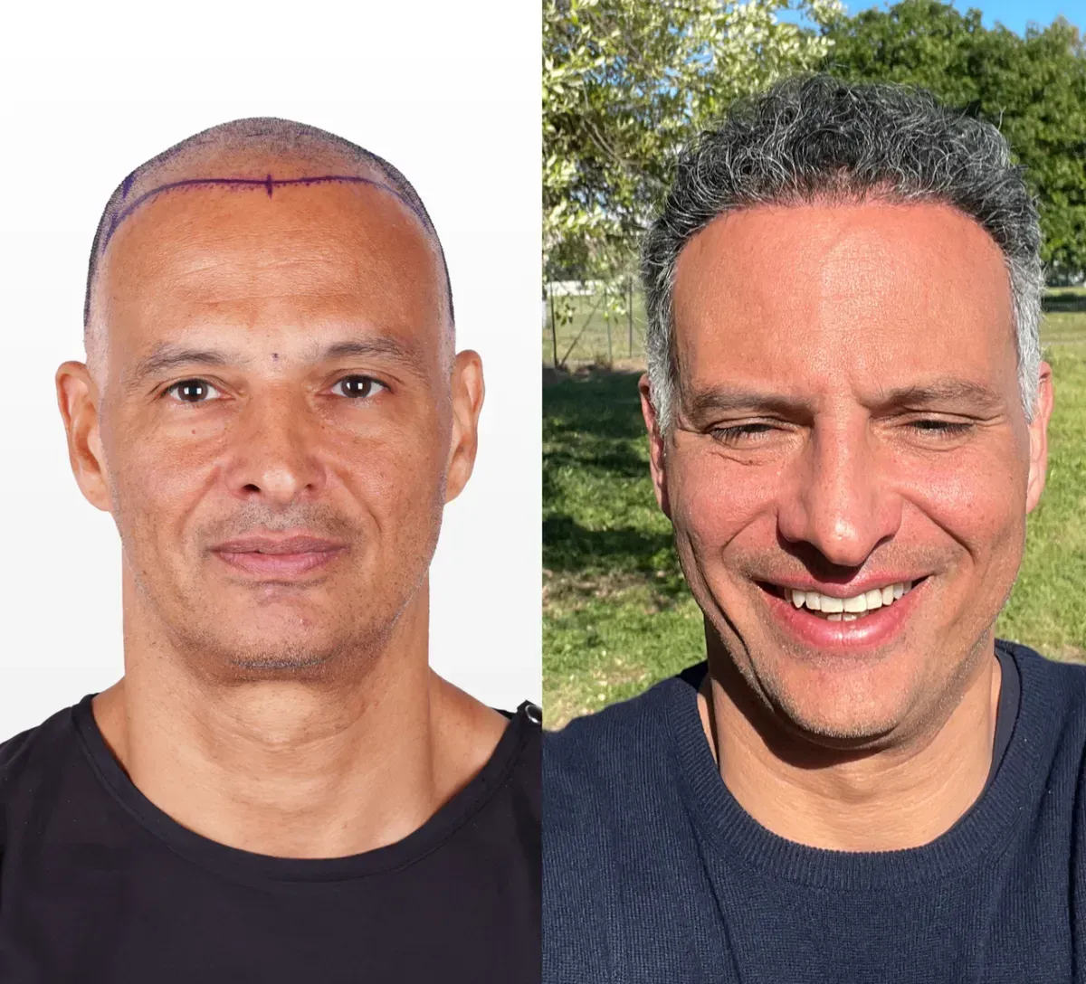 James L. before and after