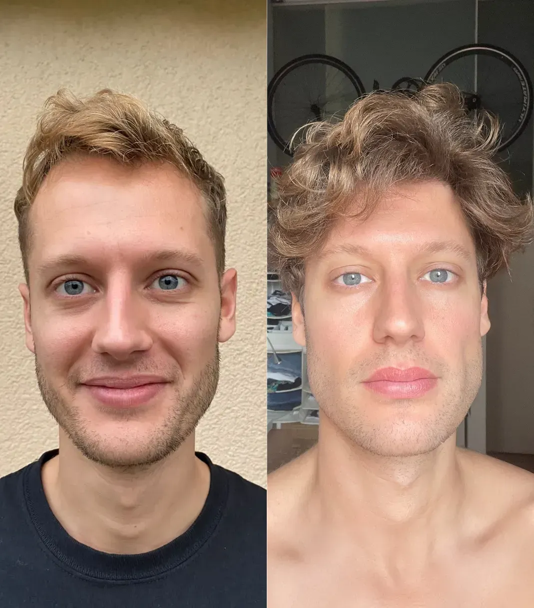 David R. before and after