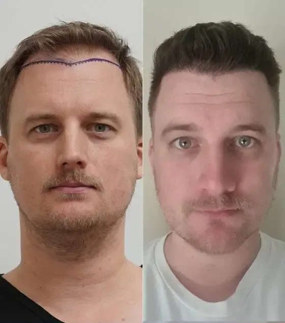 Prima e dopo