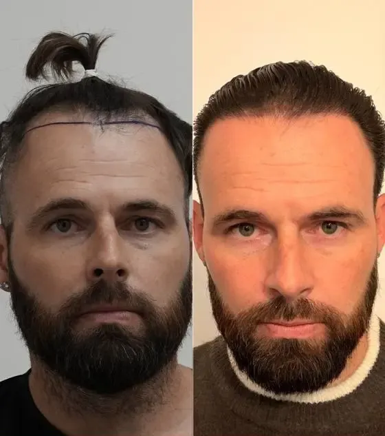Prima e dopo