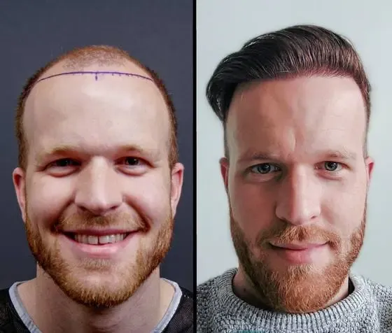 Prima e dopo