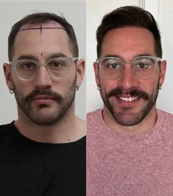 Prima e dopo