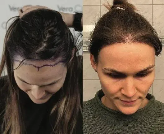 Prima e dopo
