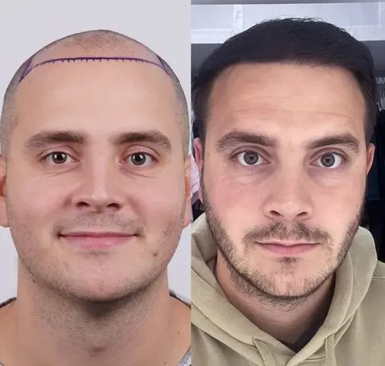 Prima e dopo