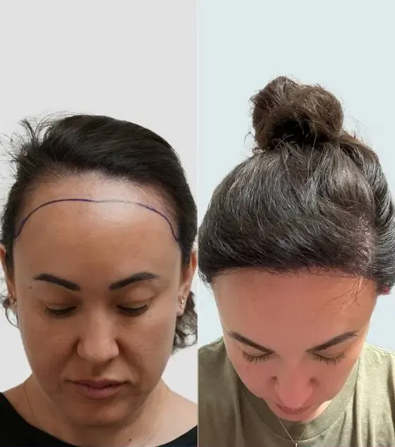 Prima e dopo