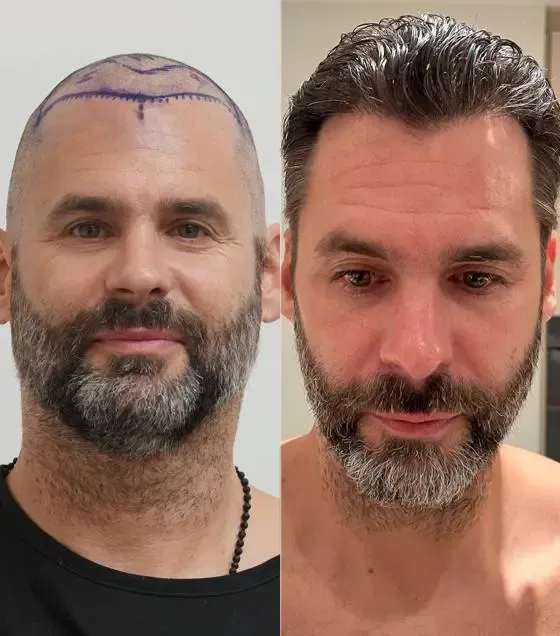 Prima e dopo